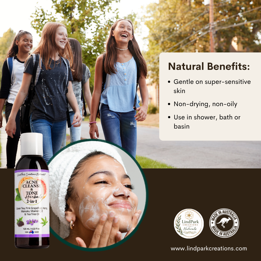 Acne Cleanse & Tone Herbal 2-in-1 (Face Wash) - Image 6