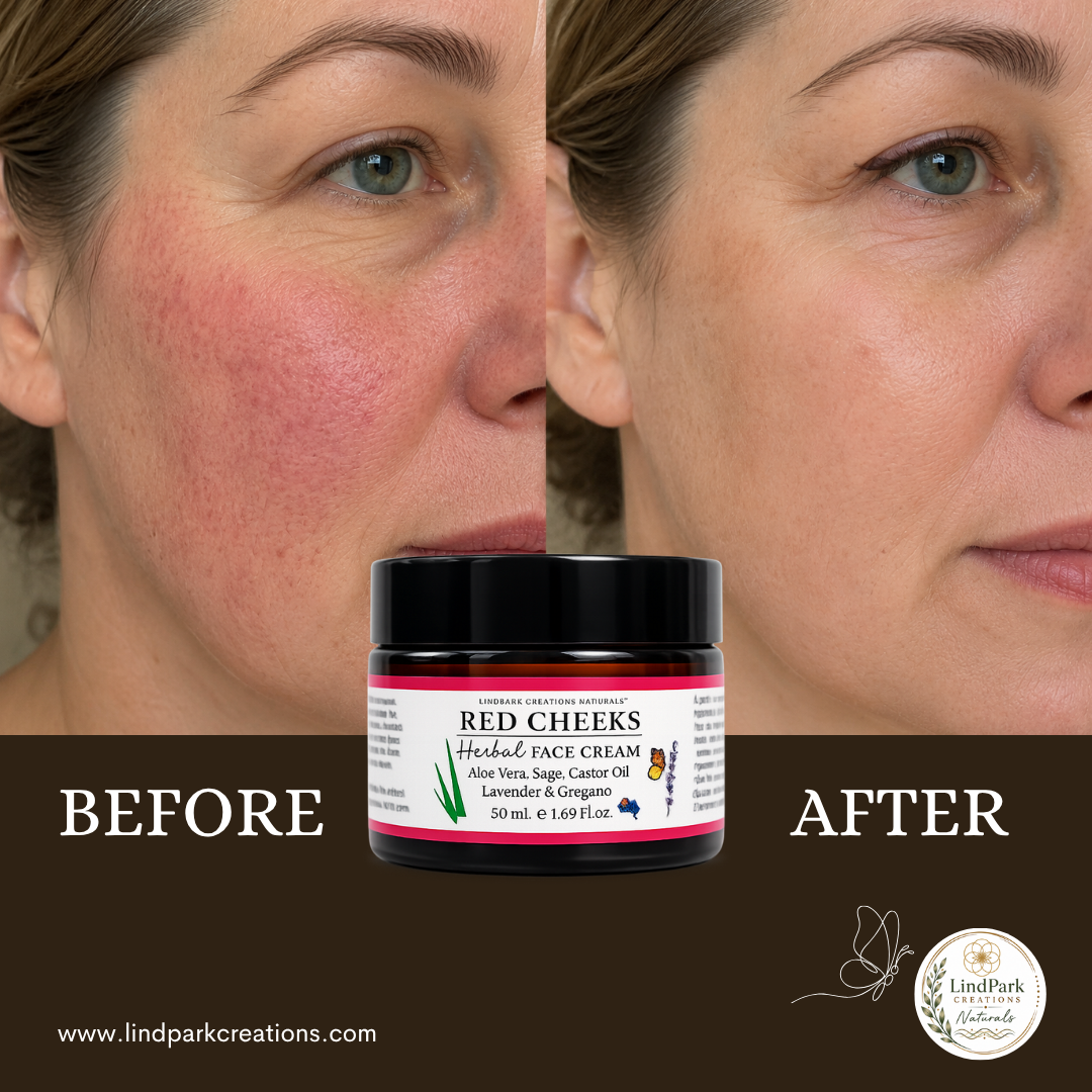 Red Cheeks Herbal Face Cream - Image 6