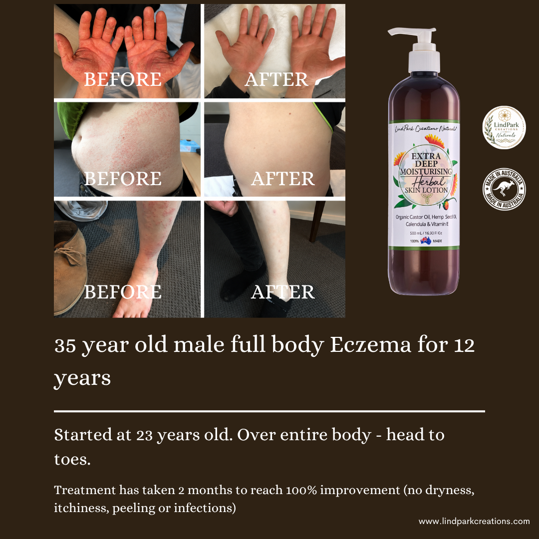 Extra Deep Moisturising Herbal Skin Lotion - Image 8