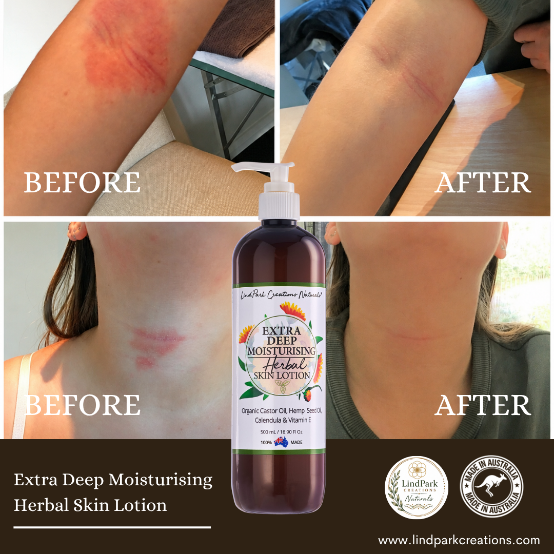 Extra Deep Moisturising Herbal Skin Lotion - Image 9