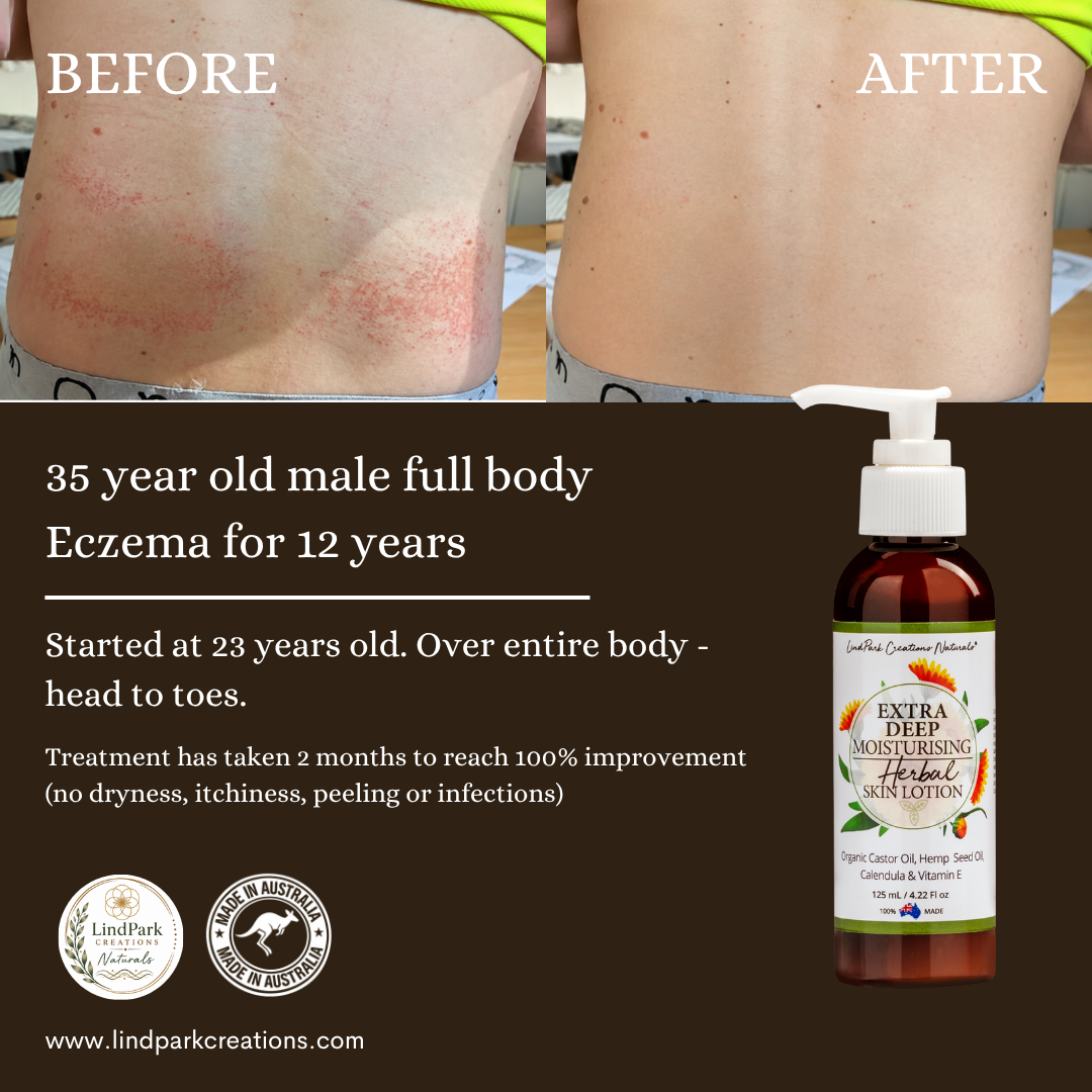 Extra Deep Moisturising Herbal Skin Lotion - Image 10