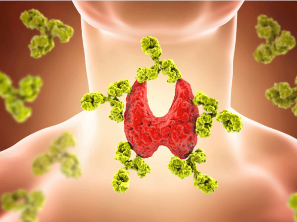 Thyroid test, thyroid imbalance, overactive thyroid, underactive thyroid