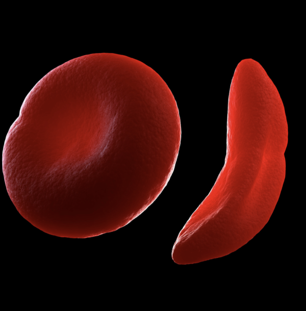 Anaemia Screen (Blood Test) - Image 3