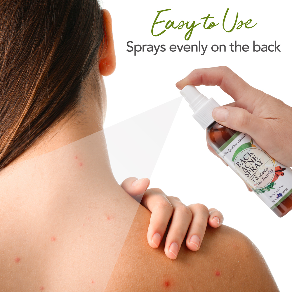Back Acne Causes & Treatment