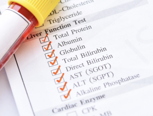 Liver Function Test - (blood) - Image 2