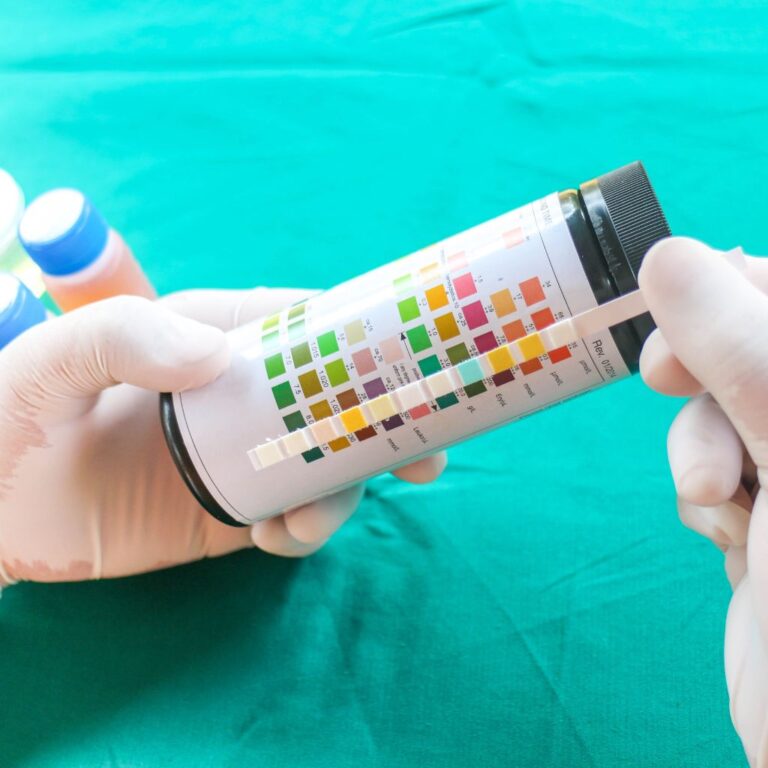 urine test