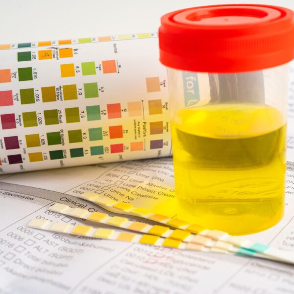 Urinalysis - Image 2