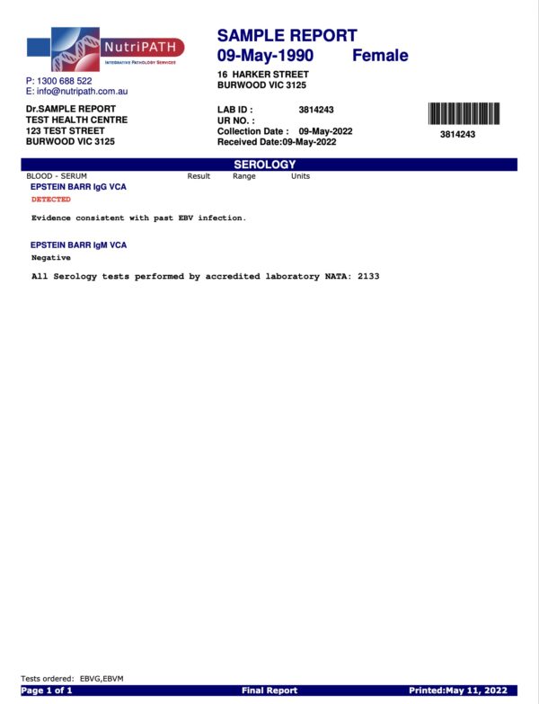 Epstein-Barr Virus (EBV) Blood Test - Image 2