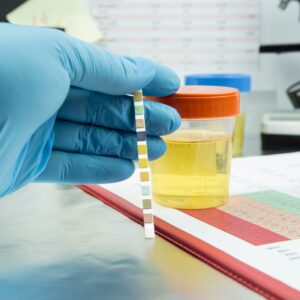 Viral Health Profile Test