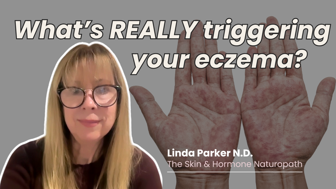Let’s Talk About Healing Eczema Naturally From the Inside Out