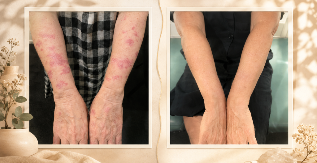 Before and After Blog Image