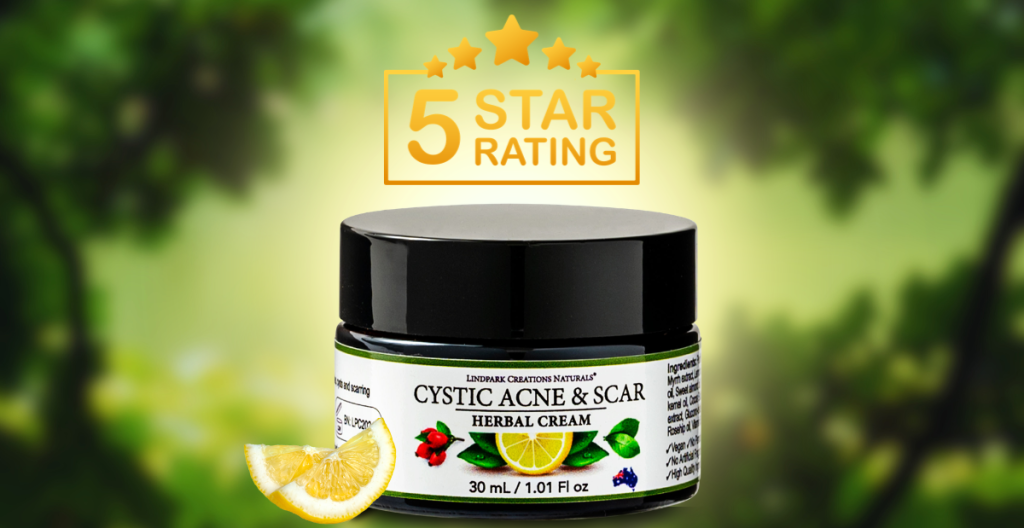 For blog images (1200 x 628 px) (14)