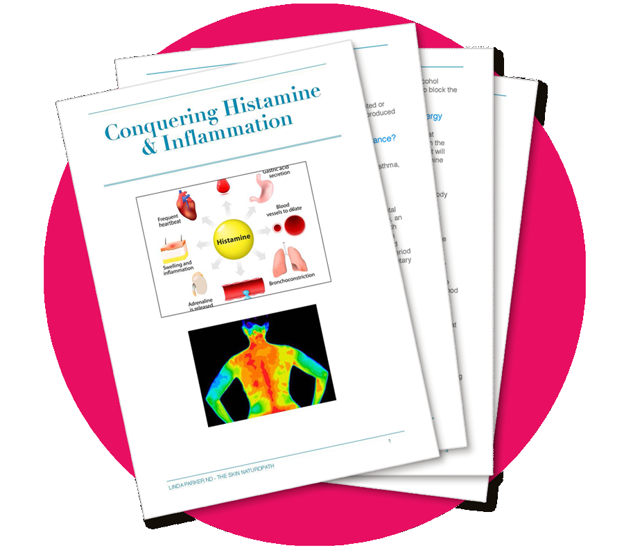 Reducing Histamine & Inflamation